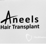 aneels-hair-transplant
