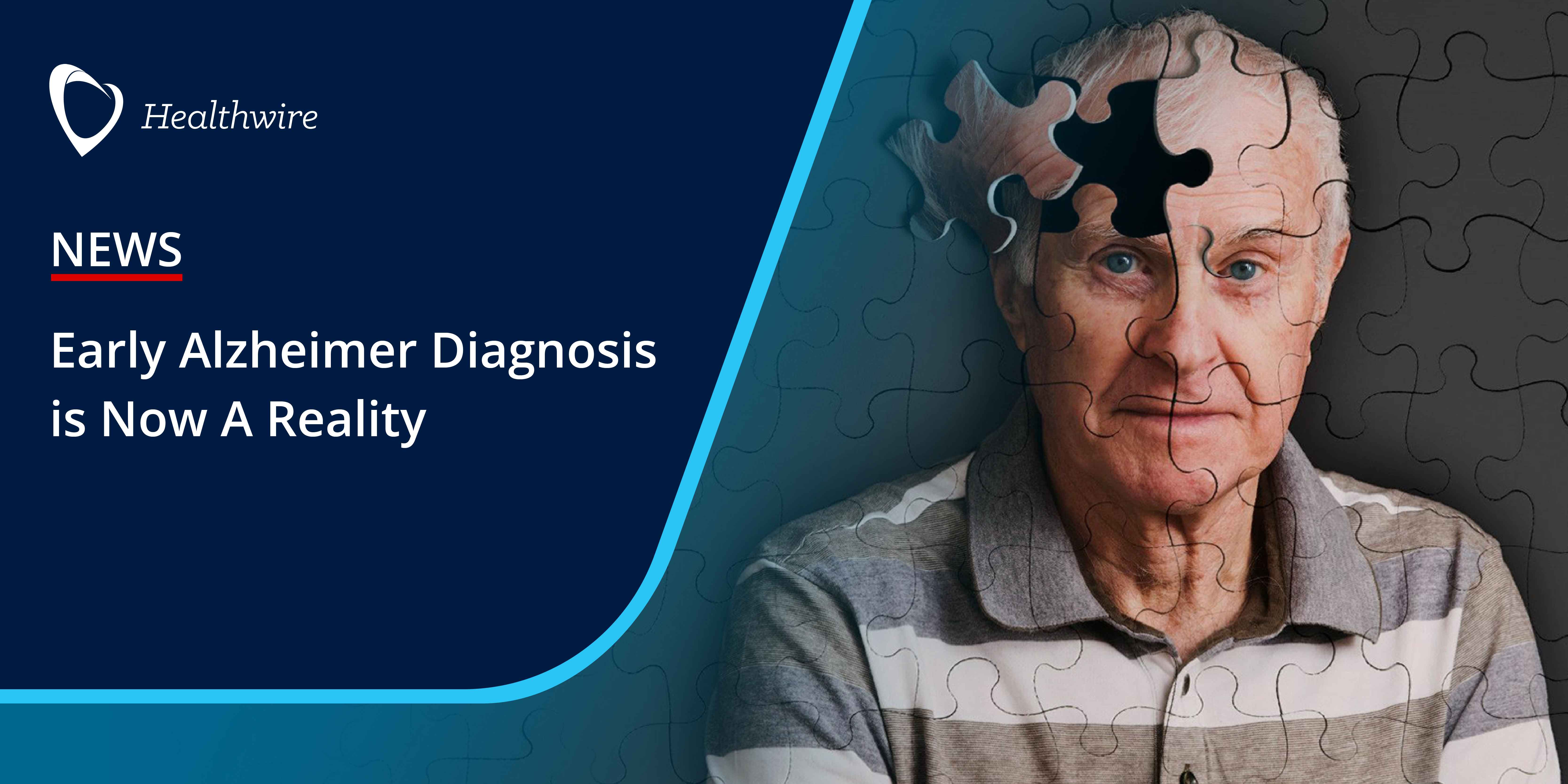 Early Alzheimer Diagnosis Is Now A Reality | Healthwire News