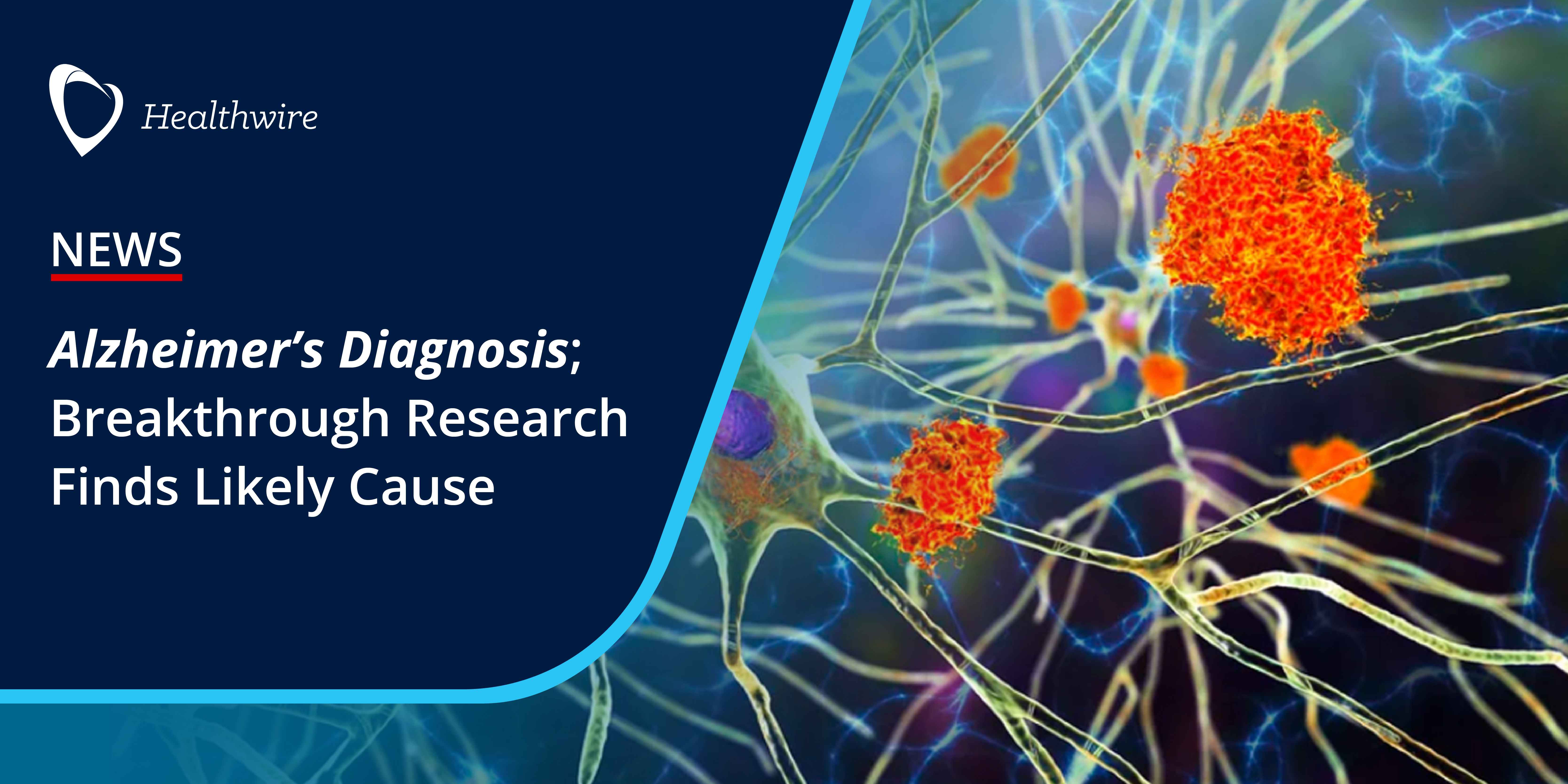Alzheimer%e2%80%99s diagnosis details 11zon