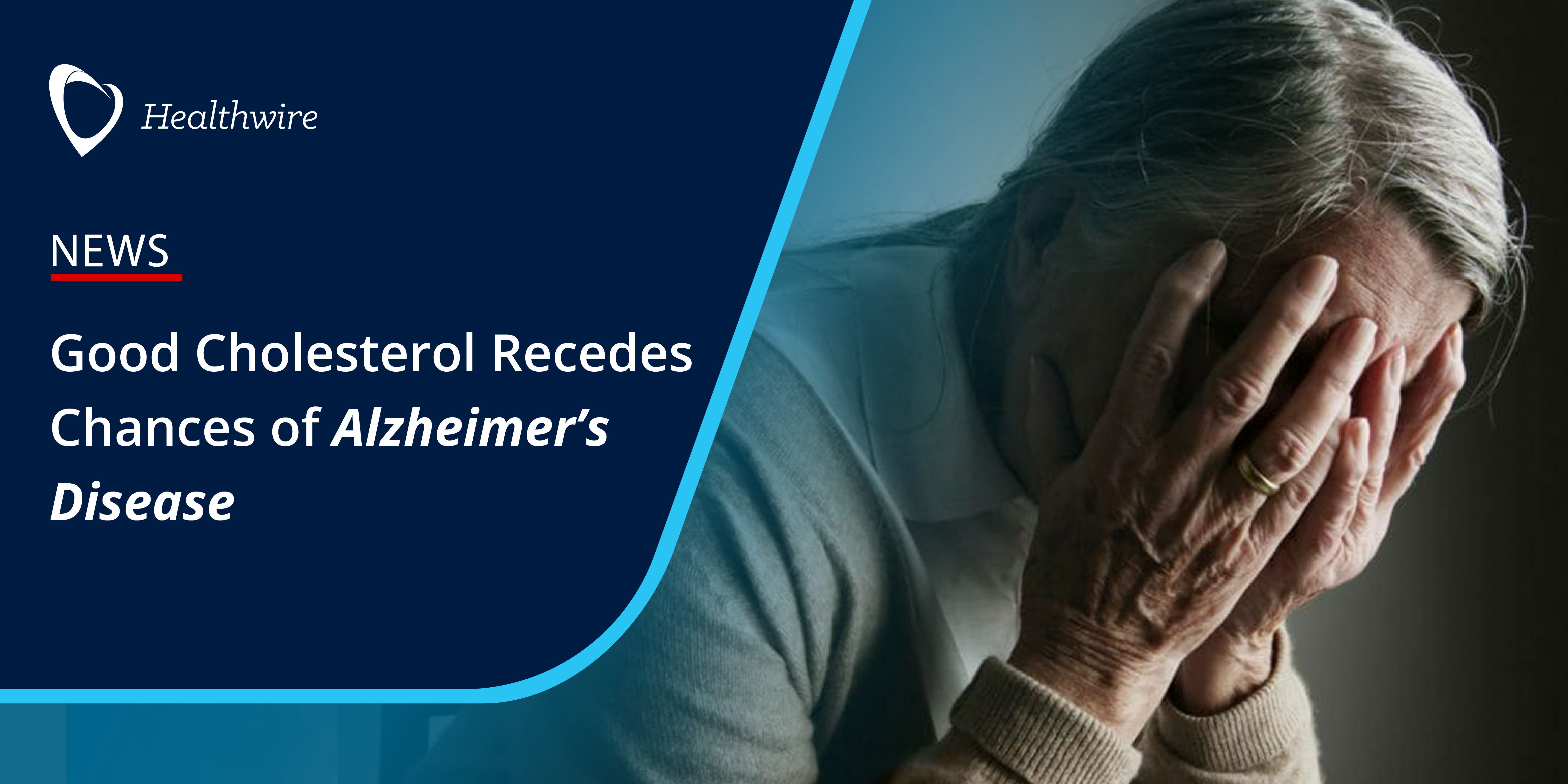 Good cholesterol recedes chances of alzheimer%e2%80%99s disease %281%29